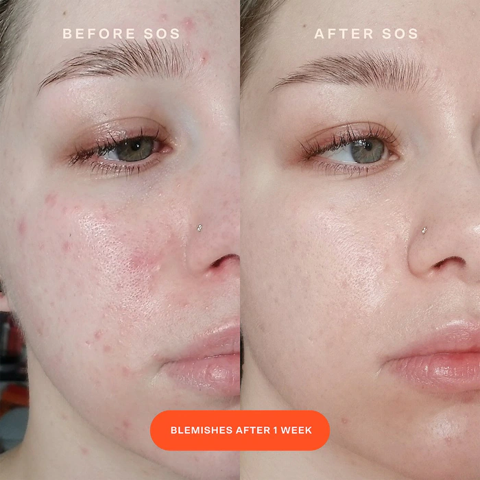 SOS Intensive Redness Relief Serum - Image 2